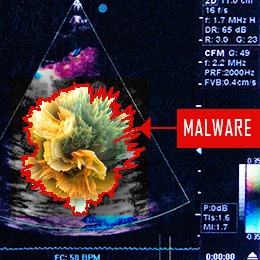imagenacion.com fotos 1 UltrasoundMalware blog 260x260